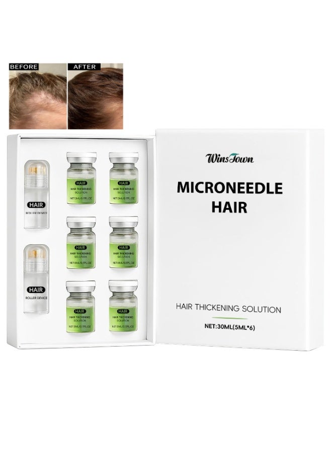 وينز تاون مجموعة محلول تكثيف الشعر بالإبر الدقيقة 30 مل | شعر أكثر كثافة، يقوي الجذور، لطيف وغير مؤلم، يدعم نمو الشعر الصحي للرجال والنساء (6 زجاجات من السيروم + 2 بكرات إبر دقيقة) - Image 1